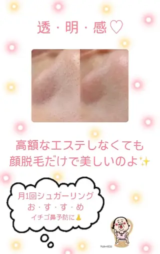 Hit. シュガーリング豊橋のエステ・リラクイメージ