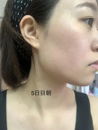 U24💗学割エステ 💗RAYVIS池袋のエステ・リラクイメージ