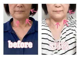 小顔と ヘッドスパのお店のエステ・リラクイメージ