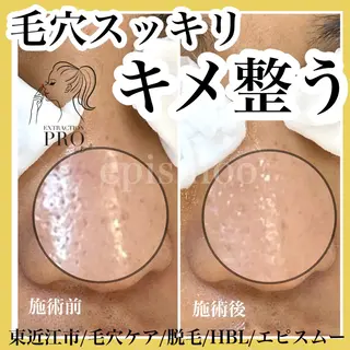 メンズ epismoo 脱毛/HBL/毛穴の眉毛・アイブロウイメージ