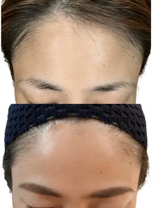 小顔/たるみ/黒ずみ除去専門サロン/SONA 大和西大寺店所属・【小顔専門看護師 サロンSONA】のエステ・リラクイメージ