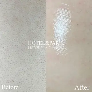 HOTEL&PARK . ワックス脱毛のエステ・リラクイメージ
