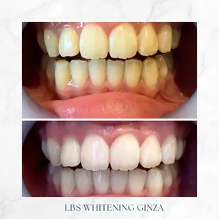 メンズ LBSホワイトニング 銀座店💎公式のその他イメージ