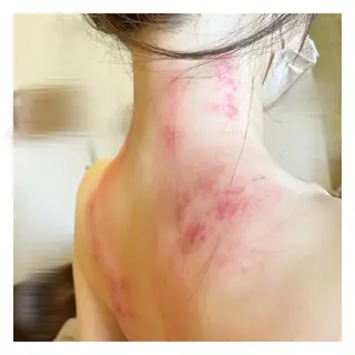 美腸専門 漢方よもぎ蒸しのエステ・リラクイメージ