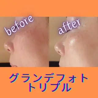 ラブニール 恵比寿店のエステ・リラクイメージ