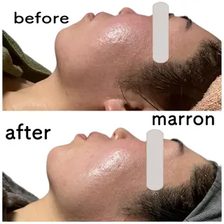 marron所属・痩身ハイパーナイフ ララピールリアボーテのエステ・リラクイメージ