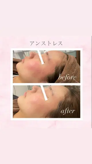 🦋美肌サロン. maho🦋のエステ・リラクイメージ