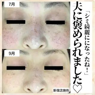 シミケア・肌改善専門 トリニエンス浦和店のエステ・リラクイメージ