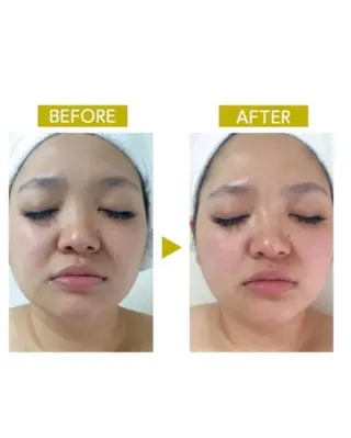 脱毛・エステサロン LuLuNのエステ・リラクイメージ