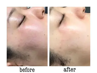 🦋美肌サロン. maho🦋のエステ・リラクイメージ