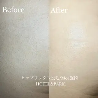 HOTEL&PARK .Moeワックス脱毛のエステ・リラクイメージ