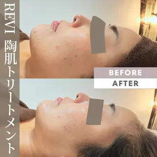 Salon💫 Lino'a柏店のエステ・リラクイメージ