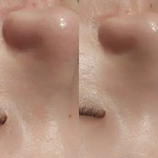 MyFairLady miuのエステ・リラクイメージ