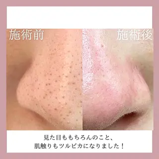 美肌脱毛&毛穴専門 Nico🐰ྀི♡のエステ・リラクイメージ