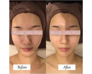 痩身×フェイシャル ブライダル|Linoのエステ・リラクイメージ