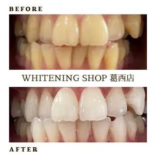 メンズ ホワイトニング ショップ葛西店のその他イメージ