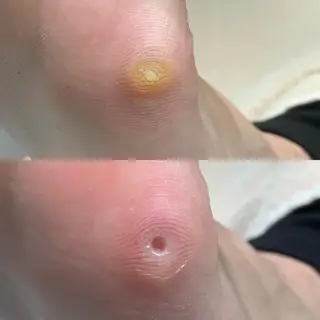 東京巻き爪アカデミー所属・東京巻き爪 アカデミーのエステ・リラクイメージ