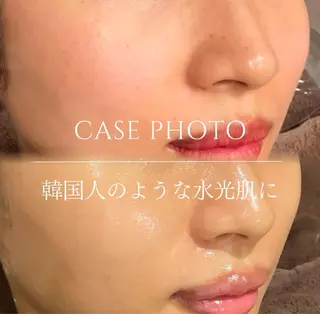 12月より リニューアルオープンのエステ・リラクイメージ