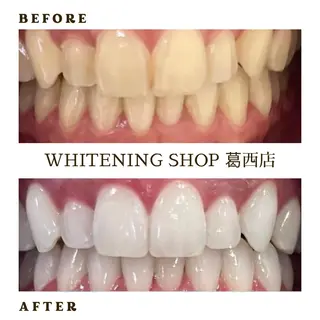 メンズ ホワイトニング ショップ葛西店のその他イメージ