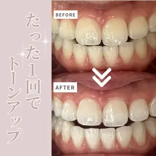 LIBRA自由が丘所属・LIBRA自由が丘 ホワイトニングのその他イメージ