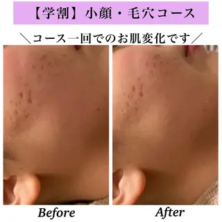 Bellesthe (ベルエステ)のエステ・リラクイメージ