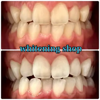 メンズ ホワイトニング ショップ川越店のエステ・リラクイメージ