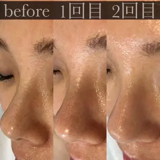 井上 真奈美のエステ・リラクイメージ