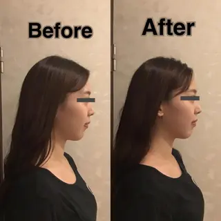 姿勢・骨盤/小顔矯正 痩身ダイエット 横田のエステ・リラクイメージ