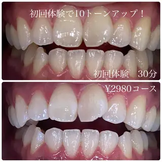 ホワイトニングルーム　川崎店所属・ホワイトニング ルーム　川崎店のその他イメージ