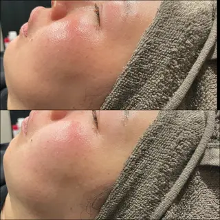 LiZA エステティックサロンのエステ・リラクイメージ