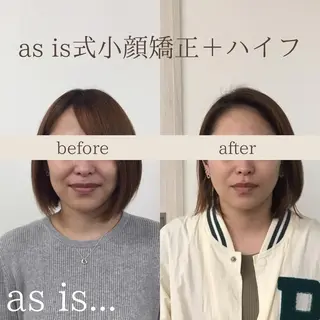 小顔専門アズイズ ビューティー　草津店のエステ・リラクイメージ