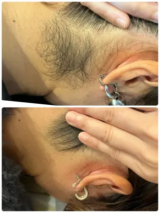 yellow.所属・yellow💛【 脱毛&フェイシャル】のエステ・リラクイメージ