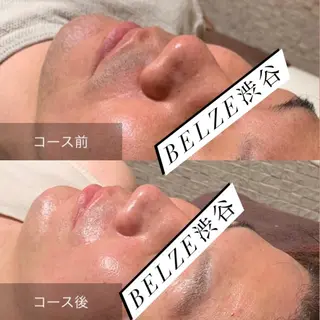 メンズ 渋谷ベルゼ🌷木下 毛穴/脱毛/フェムのエステ・リラクイメージ