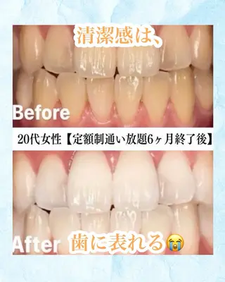 メンズ キッズ ホワイトニング専門店 WHITE天神店のエステ・リラクイメージ