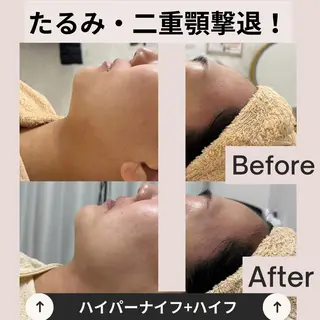 aimer SASAKIのエステ・リラクイメージ
