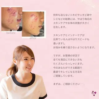 ベラージュ【美背中・ 美尻・フェイシャル】のエステ・リラクイメージ