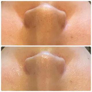 yellow.所属・yellow💛【 脱毛&フェイシャル】のエステ・リラクイメージ