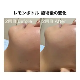 Petit pas所属・プライベートサロン Petit pasのエステ・リラクイメージ