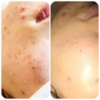 【足圧】鬼👹リンパ 身体整うサロンのエステ・リラクイメージ