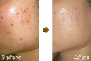 メンズ 美容鍼灸サロン LOMIHARIのエステ・リラクイメージ