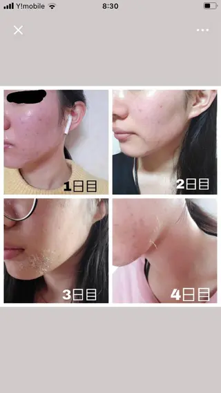 ロング カラー パーマ ヘアアレンジ メンズ キッズ ネイル マツエク・マツパ ハーブピーリング専門 🌿モッカのエステ・リラクイメージ