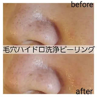 メンズ 小顔・美肌ケア専門 Diva北浜のエステ・リラクイメージ