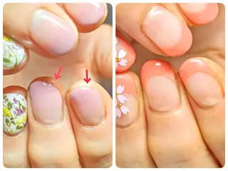 ネイル 深爪矯正/爪育成ケア manie nailのネイルデザイン