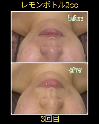 ラブニール 恵比寿店のエステ・リラクイメージ