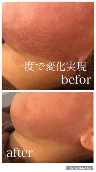 セミロング カラー パーマ ヘアアレンジ メンズ キッズ ネイル マツエク・マツパ 四つ星サロン🎖 腸＆ニキビケアに特化のエステ・リラクイメージ