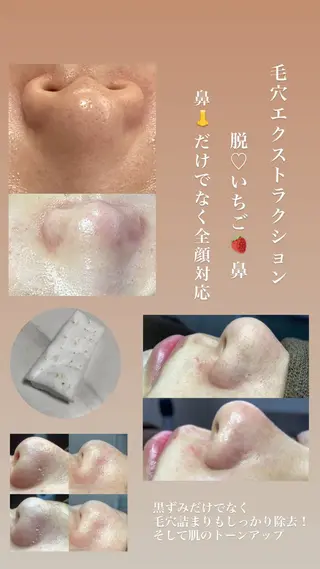 salon de Nのエステ・リラクイメージ