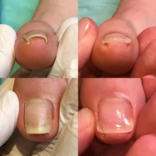 ネイル 東京巻き爪アカデミー所属・東京巻き爪 アカデミーのエステ・リラクイメージ