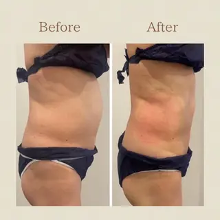 お腹痩せエステ Flat BELLY 恵比寿所属・【腸もみ/冷却痩身】 お腹エステ/恵比寿のエステ・リラクイメージ