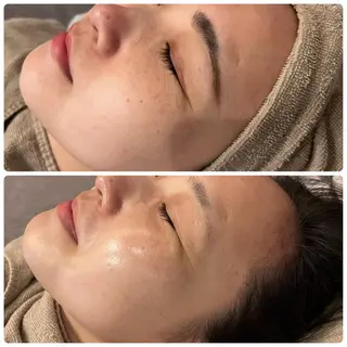 yellow.所属・yellow💛【 脱毛&フェイシャル】のエステ・リラクイメージ