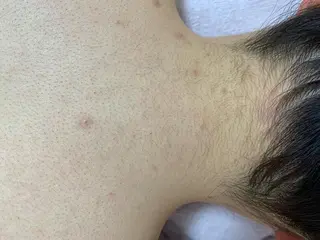 キッズ 脱毛SALON RaYNiCKのエステ・リラクイメージ